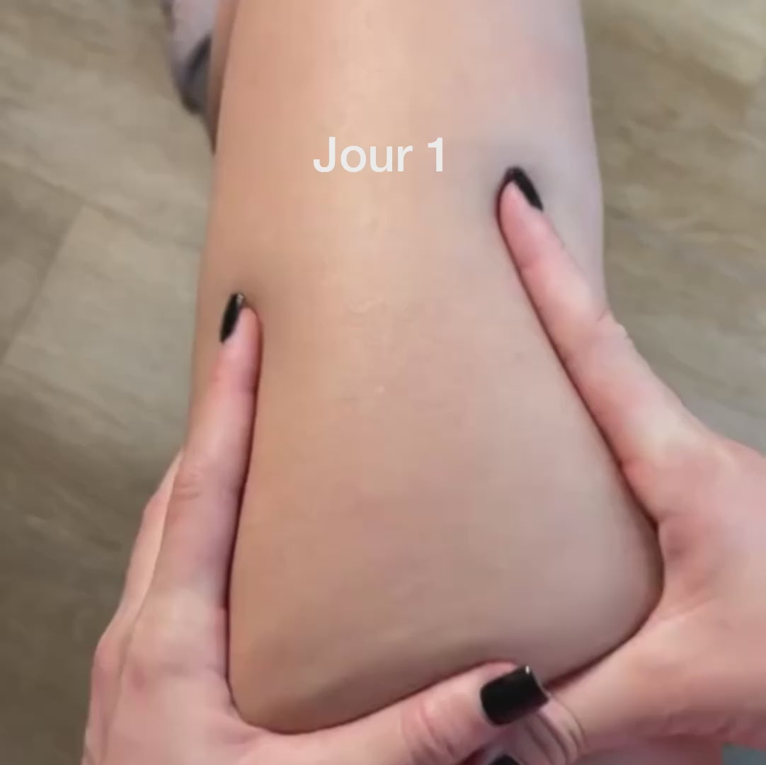 Mielane Sculpt - 14 jours pour une peau visiblement plus belle.